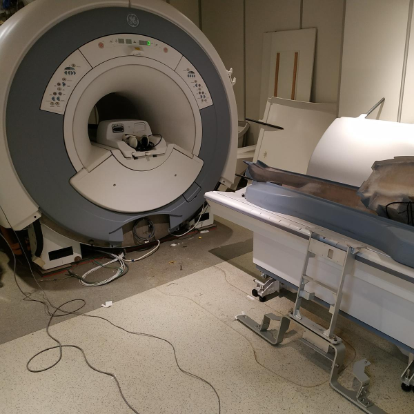 GE 1.5T Signa Optima 360 Advance 25X