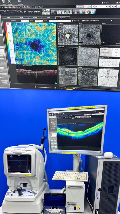 Nidek RS-3000 Advance