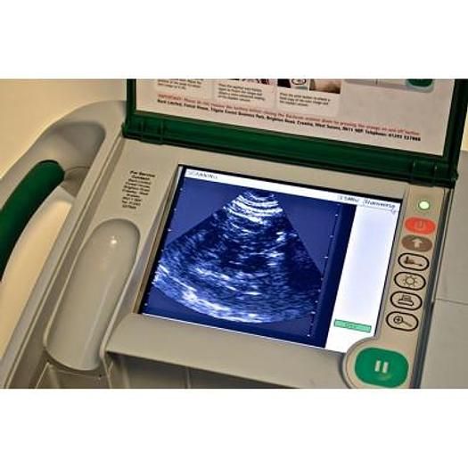 Bard Scan Portable Prostate Urology Ultrasound