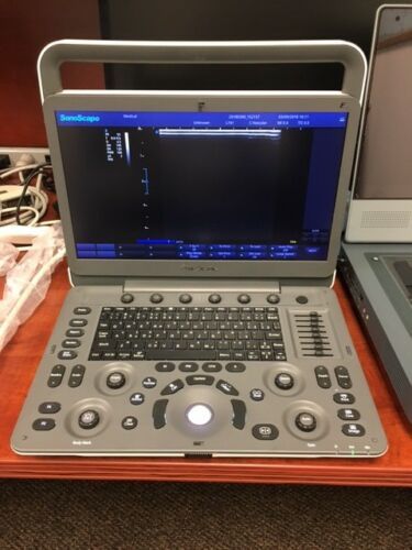 Sonoscape E1 Portable Ultrasound System