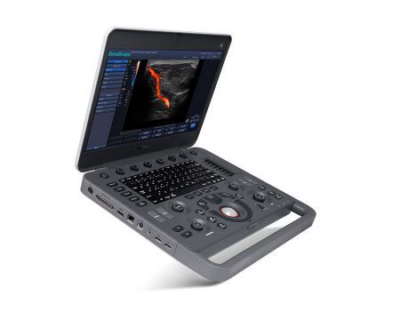 Sonoscape X5 Ultrasound