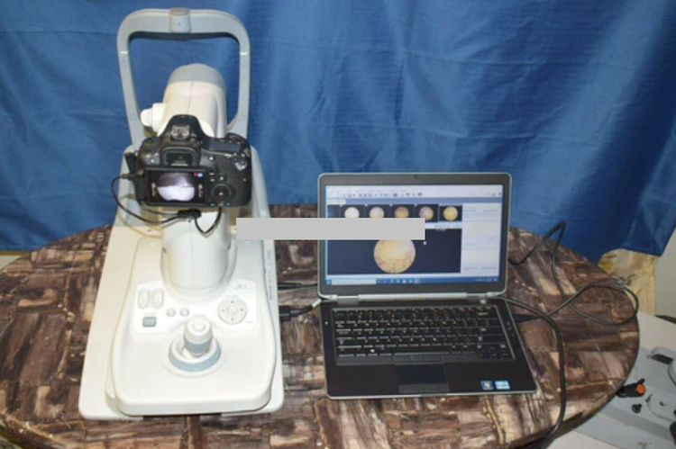 Canon CR-2 Retinal Camera