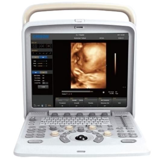 Chison Q5 Ultrasound