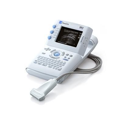 Sonosite 180 Ultrasound System - Refurbished