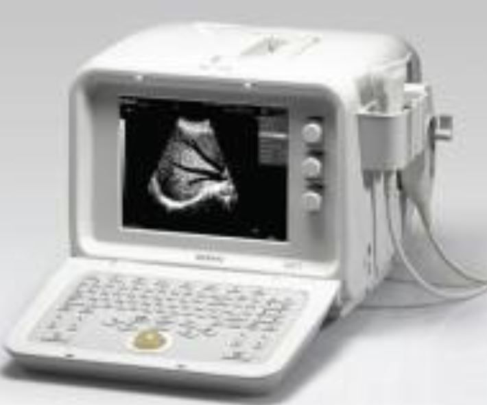 Edan DUS 3 Portable Black and White Ultrasound