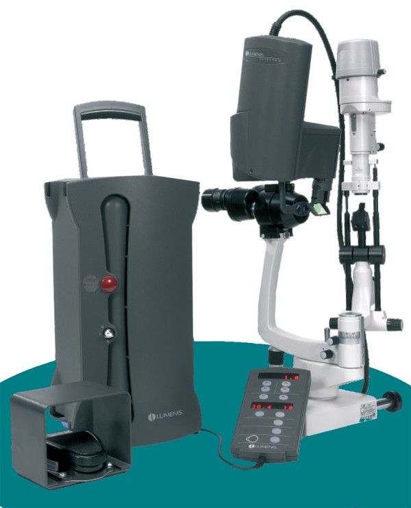 Lumenis Selecta II SLT Laser System (Trabeculoplasty