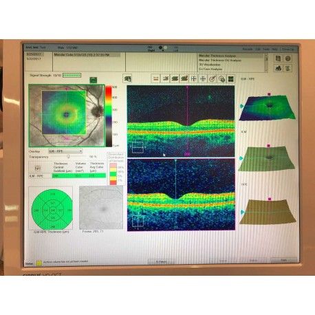 Carl Zeiss Cirrus HD-OCT 5000