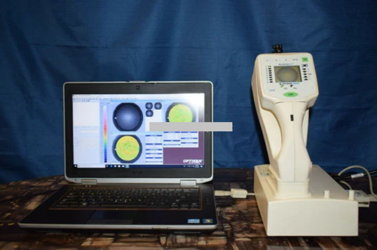 Optikon Keratron Scout Corneal Topographer