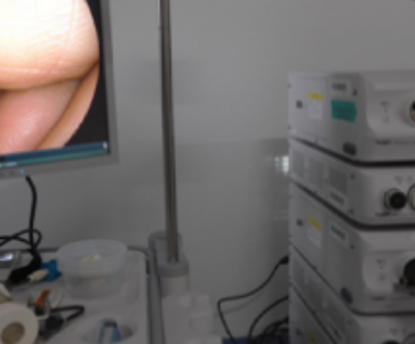 Fujinon 4450