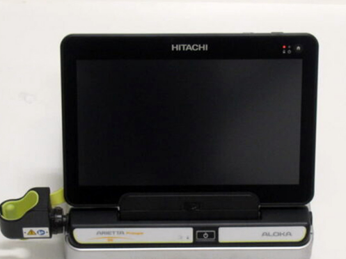 Hitachi ARIETTA Prologue Portable Ultrasound