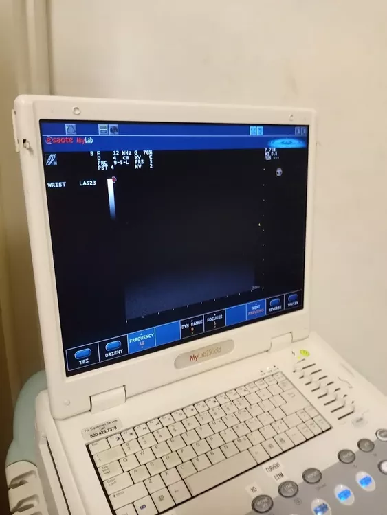 Esaote MyLab 25Gold Ultrasound Machine