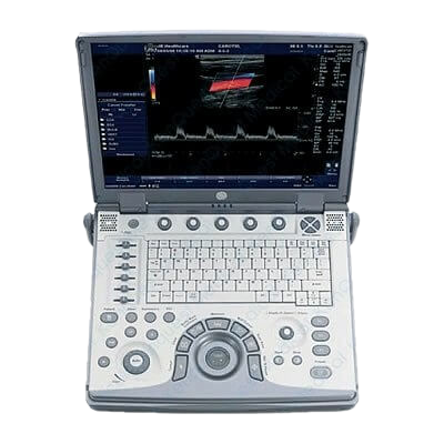 GE Logiq e Portable Ultrasound