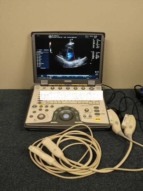 GE LOGIQ e Ultrasound