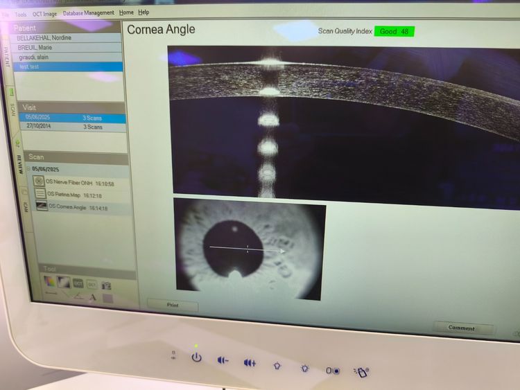 Optovue I-Vue 100-2