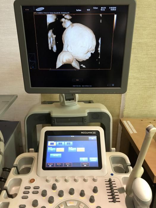 Samsung Accuvix XG Ultrasound Machine