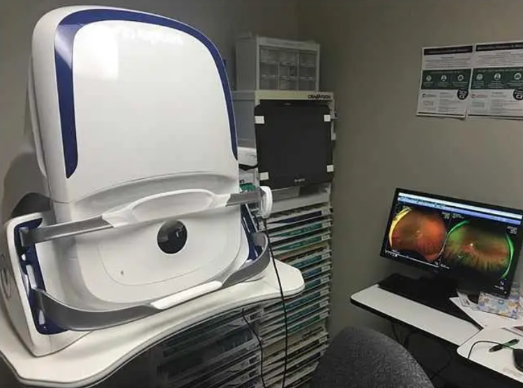 Optos Monaco Ultra WideField Retina Imaging