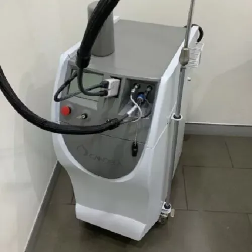 Candela GentleYAG Laser