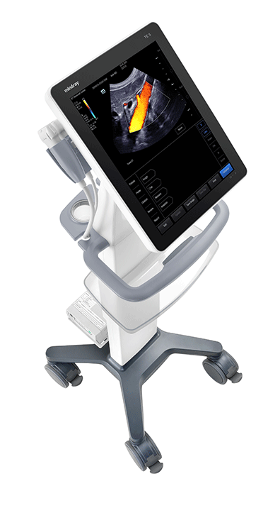 Mindray TE5 Ultrasound