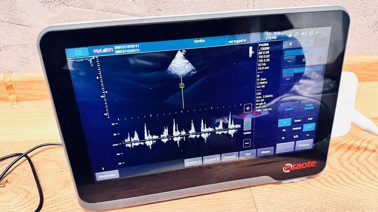MyLab X1 Ultrasound