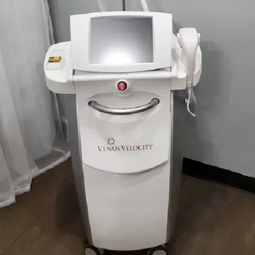 Venus Velocity Laser Removal