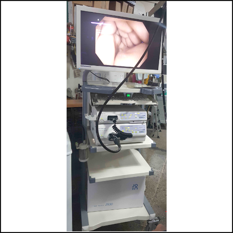 Olympus CV-180 Complete endoscopy system