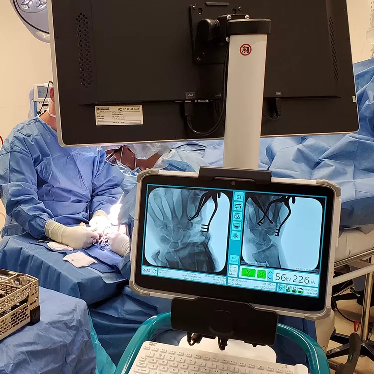 Smart-C Mobile C-Arm
