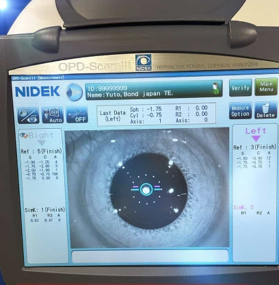 Nidek OPD-Scan III Refractive Power