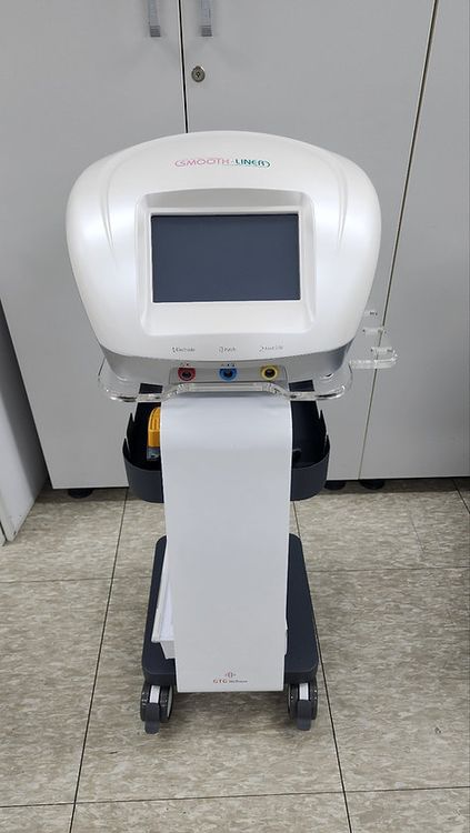 Smooth-Liner Radio Frequency