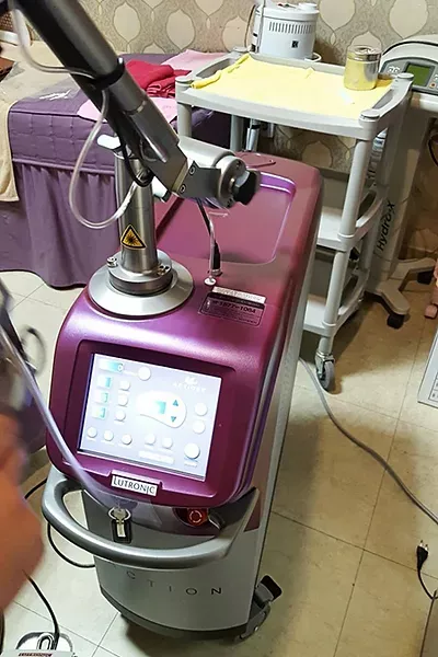 Lutronic Action II YAG Laser System