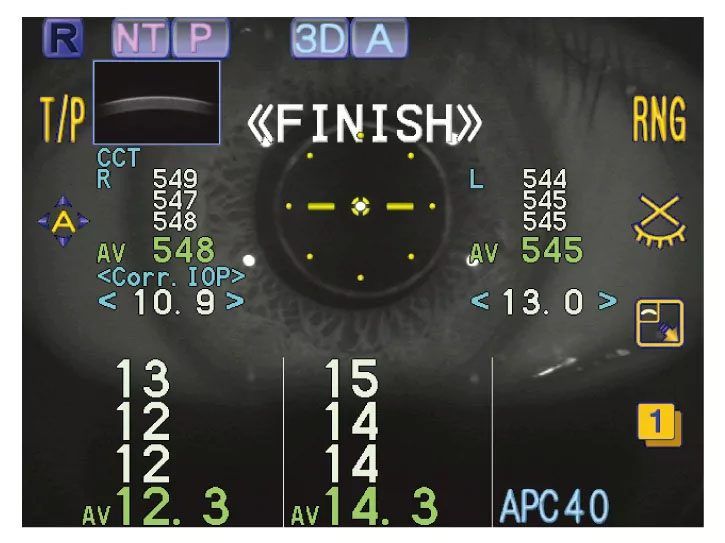 Nidek NT-530P Tonopachy