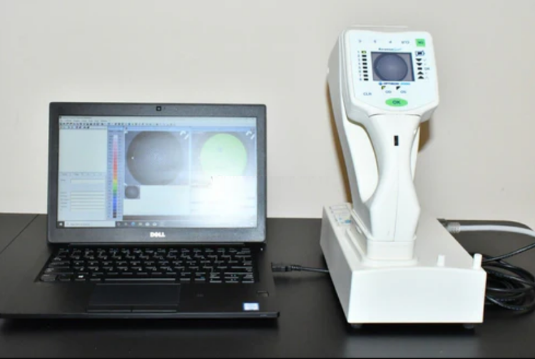 Optikon Keratron Scout portable Corneal Topographer