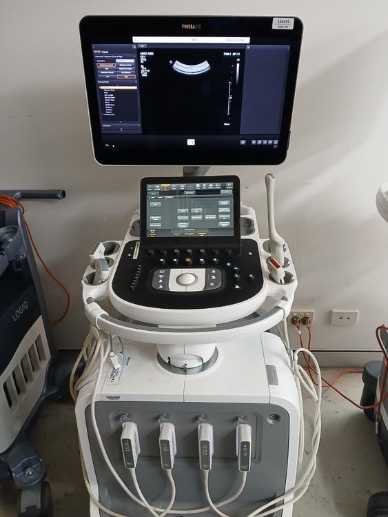 Philips Epiq 5G Ultrasound