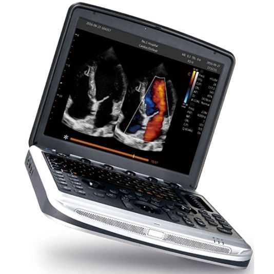 Chison SonoBook 8