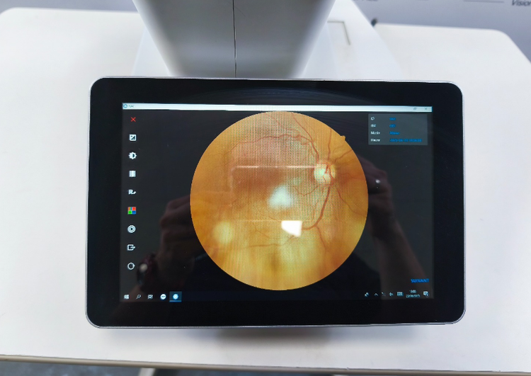 NFC-700 Non-Mydriatic Retinal Camera