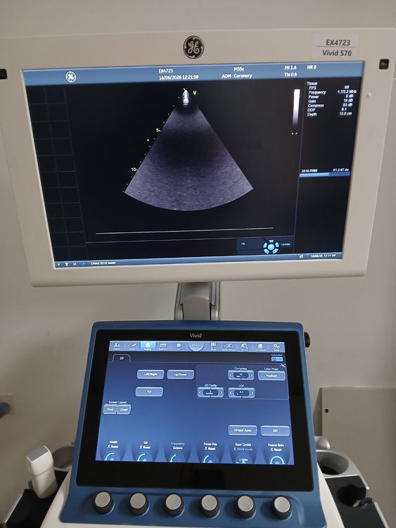 GE Vivid S70