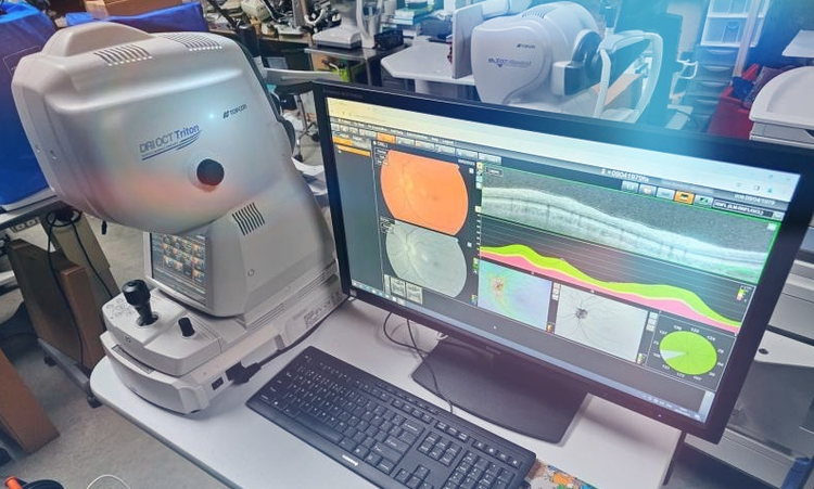 Topcon Triton Swept Source OCT