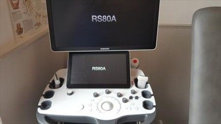 Samsung RS80 ultrasound