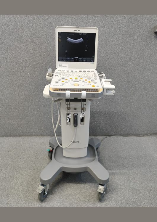 Philips Diamond Select CX50 ultrasound scanner