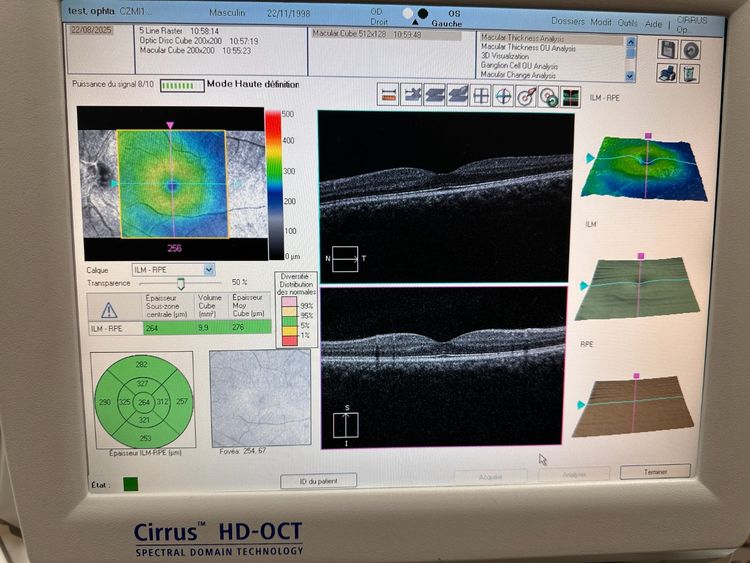ZEISS Cirrus 400 HD-OCT