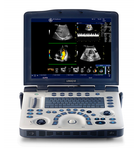 GE Logiq V2 Color Ultrasound System