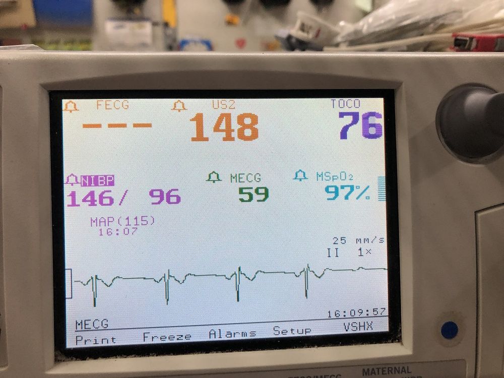 GE Healthcare Corometrics 250cx Series Maternal/Fetal Monitor