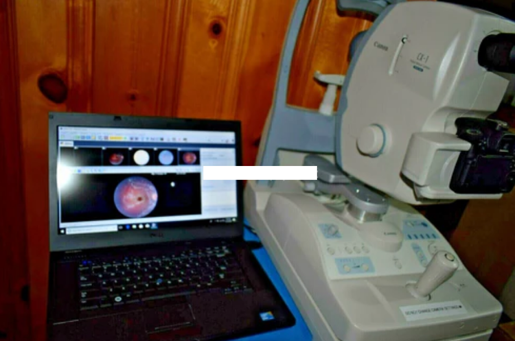 Canon CX-1 Fundus retinal camera non-myd/mydriatic FAF Fluorescein FFA