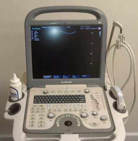 Sonoscape S8 Portable Ultrasound