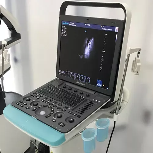 Sonoscape S8 Portable Ultrasound