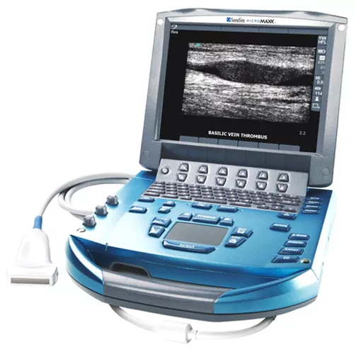 Sonosite MicroMaxx Ultrasound
