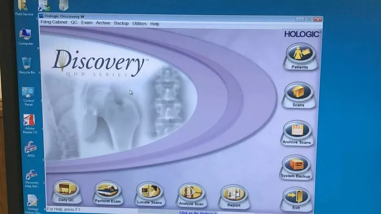 Hologic Discovery C Bone Densitometer DEXA System