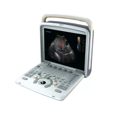 Chison Q5 Ultrasound