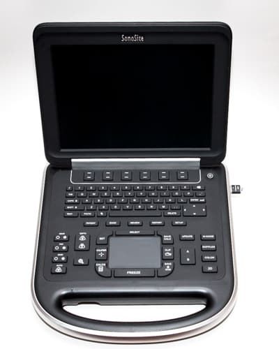 Sonosite Edge Ultrasound System