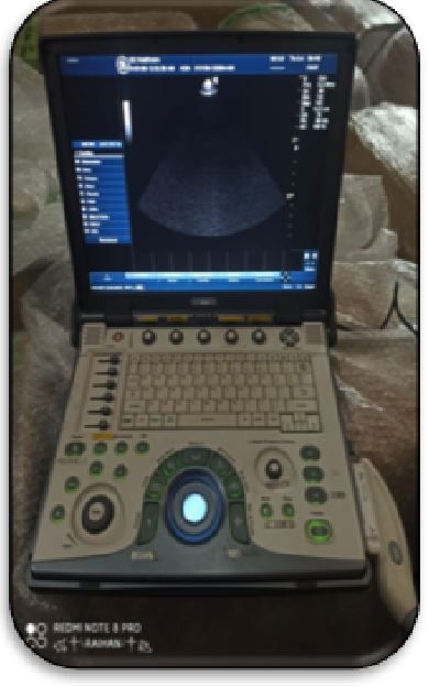 GE Logiq E Ultrasound