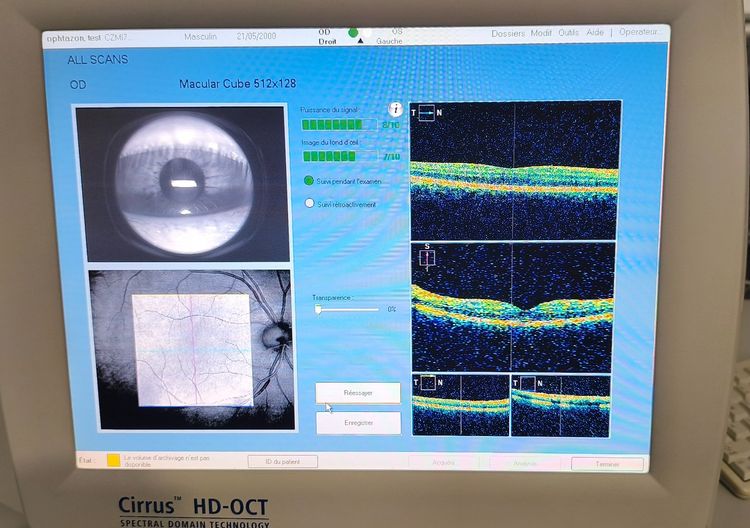ZEISS Cirrus 4000 HD-OCT